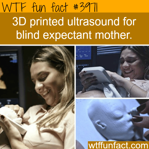 3D printed ultrasound for blind mother - WTF fun facts 