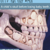 a child s skull before losing baby teeth