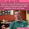 a man with down syndrome opens a restaurant