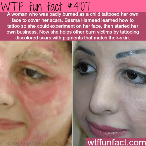 A woman tattoos the ’burn scars of her face - WTF fun facts