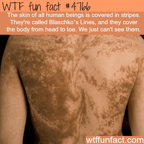 All humans have stripes on their skin - WTF fun facts