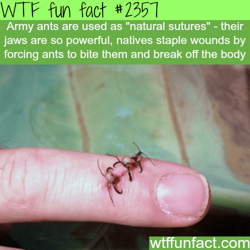 Army ants “Natural sutures” - WTF fun facts