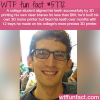 college student 3d prints his own braces wtf fun