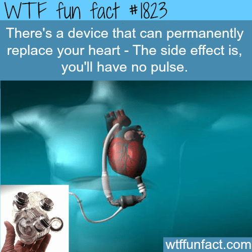 Device that replace heart - WTF fun facts
