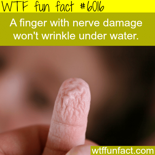 Fingers won’t wrinkle if they have nerve damage - WTF fun facts