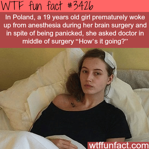 Girl wakes up in the middle of her brain surgery -  WTF fun facts