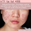 how to solve your acne problem wtf fun facts