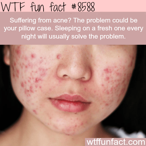 How to solve your acne problem - WTF fun facts