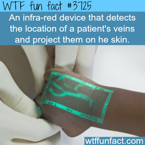 Infra-red device help see a patient’s veins -  WTF fun facts