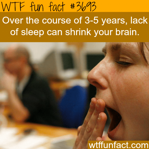 Lack of sleep can affect the size of your brain -  WTF fun facts