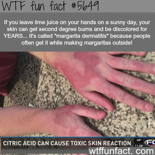 Lime juice can cause second degree burns - WTF fun fact