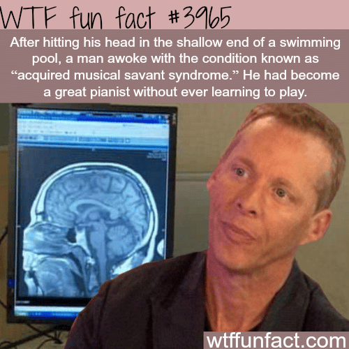 Man acquires musical skills after hitting his head - WTF fun facts