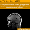 mri scans of elderly people who exercise look