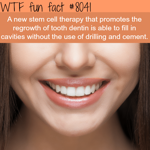 New stem cell therapy can grow teeth and fill cavities - WTF fun facts 