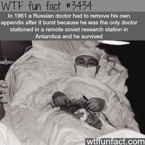 Russia surgeon preforms surgery on himself -  WTF fun facts