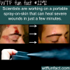 spray on skin that can heal severe wounds