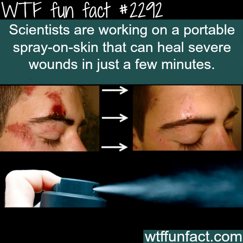 Spray on skin that can heal severe wounds - WTF fun facts
