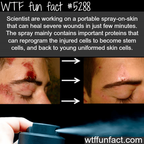 Spray that can heal severe wounds - WTF fun facts