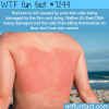sunburn wtf fun fact