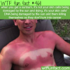 sunburns cause your sells to commit suicide wtf