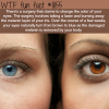 surgery that will change brown eyes to blue wtf