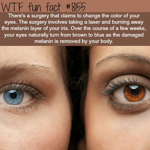 Surgery that will change brown eyes to blue - WTF fun fact