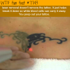tattoo laser removal wtf fun facts