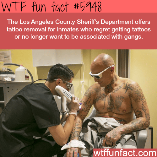 Top 74 tattoo removers ink super hot  thtantai2