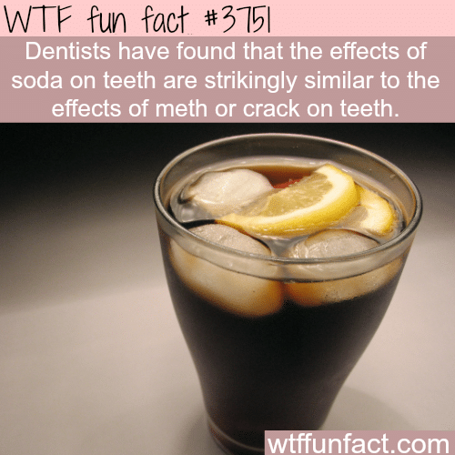 The effects of Soda on teeth - WTF fun facts