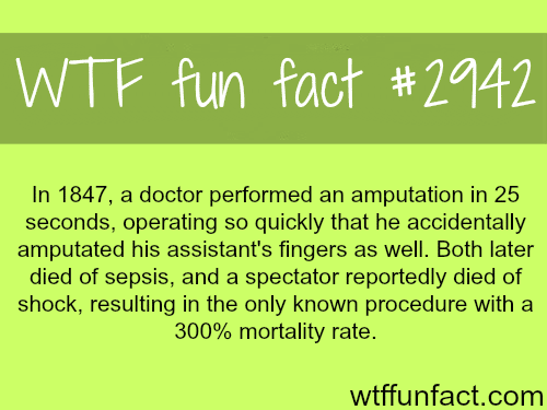 The fastest surgery in the world -  WTF fun facts