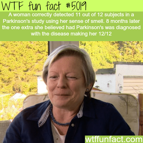 This woman can detect Parkinson disease early with her nose - WTF fun facts
