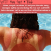 why you should avoid sunburns wtf fun facts