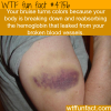 why your bruise turns colors wtf fun facts