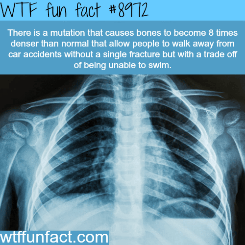 Worlds densest bones - WTF fun fact