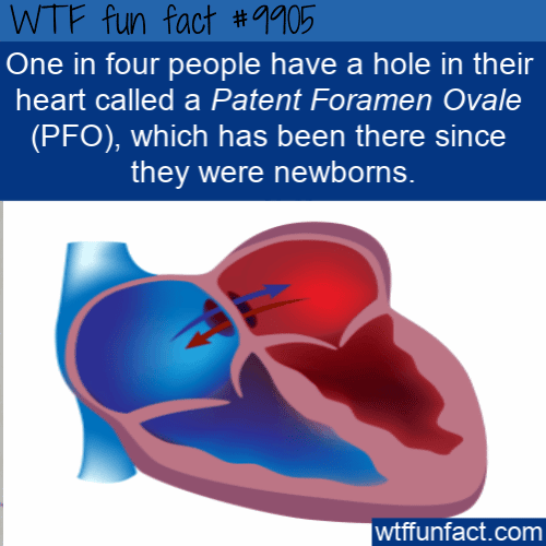 fun health fact one in four of us has a hole in heart