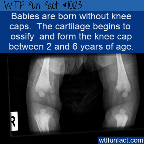 WTF Fun Fact - Baby Knee Caps
