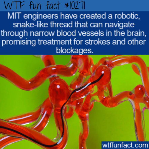 WTF Fun Fact - Robotic Treatment