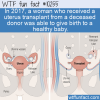 WTF Fun Fact – Uterus Transplant Success