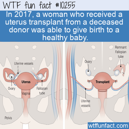 WTF Fun Fact - Uterus Transplant