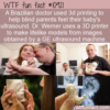 WTF Fun Fact – 3D Ultrasound