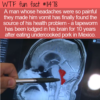 WTF Fun Fact – Tapeworm In Brain