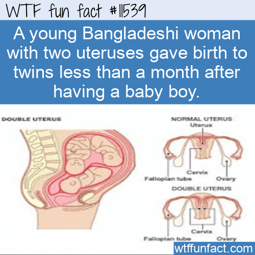 WTF Fun Fact - Two Uteruses And Twins