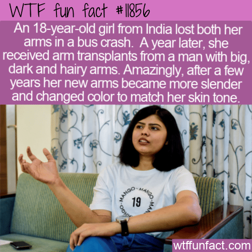 WTF Fun Fact - Unusual Arm Transplant Behavior