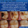 WTF Fun Fact – Gel To Regrow Tooth Enamel