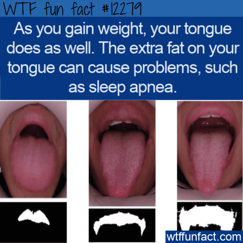 WTF Fun Fact - Tongue Fat
