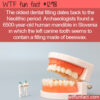 WTF Fun Fact 12918 – The First Dental Filling