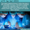 WTF Fun Fact 13054 – Longest Surgery Ever Performed